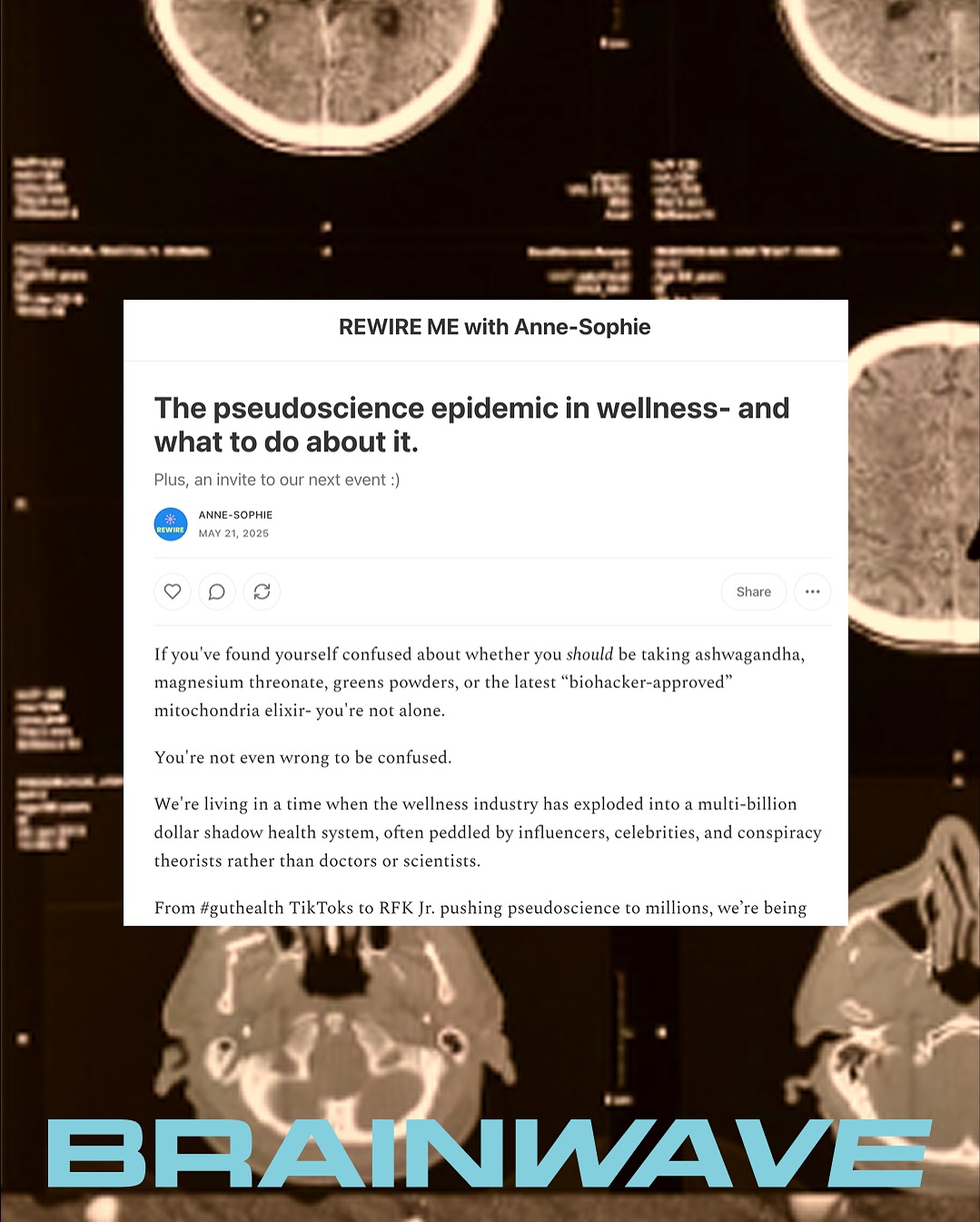 Brainwave on neuroscience, overload, and health literacy
